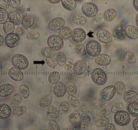 Cryptosporidium and Coccidia Exam, Fecal